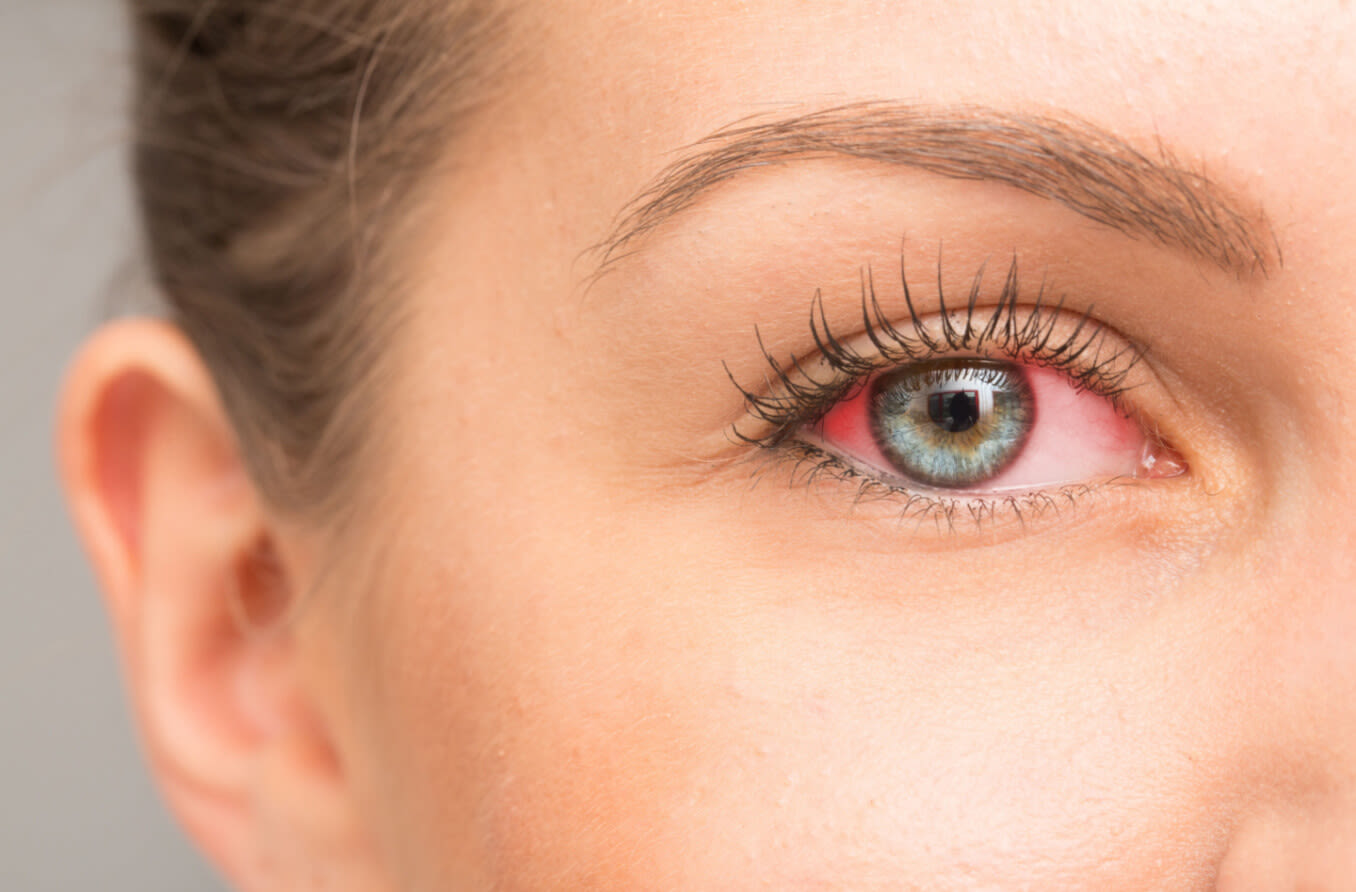 Dry eye symptoms and treatment