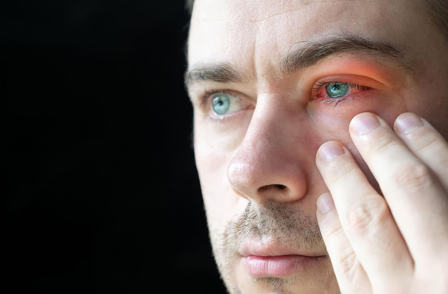 Dry_Eye_symptoms_Invercargill_NZ